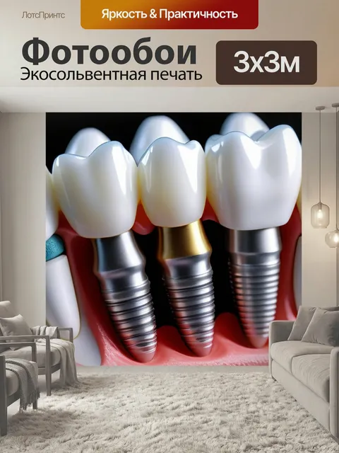 Фотообои Имплантация коронки на искусственный зуб